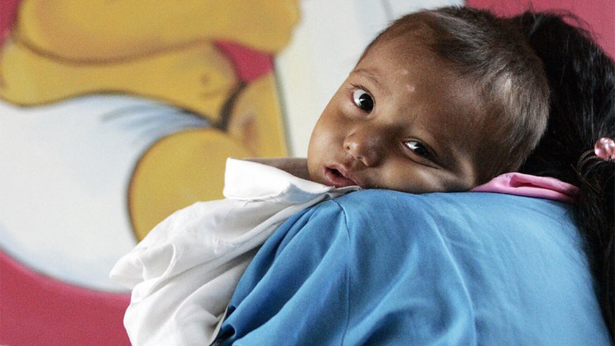 LA POBREZA EN GUATEMALA Y LA FALTA DE ALIMENTACIÓN A CON LLEVADO A LA DESNUTRICIÓN EN NIÑOS.
