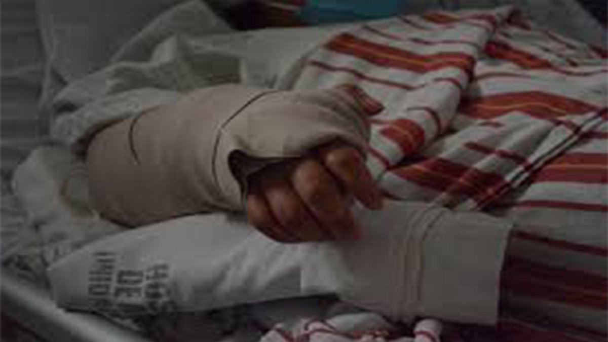 Médicos reconstruyen la mano de una joven en el Hospital de Amatitlán.
