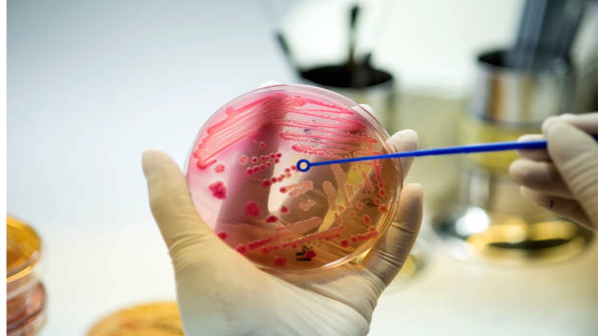 Lanzan Alerta del Primer caso de Candida Auris